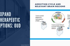 Interventions to Address Opioid Addiction