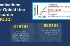 Interventions to Address Opioid Addiction